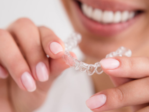 Free-Clear-Aligner-Consultation