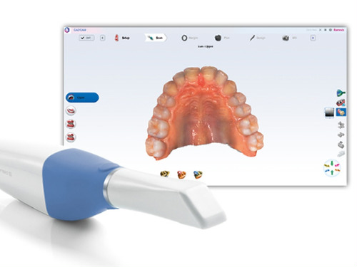Digital Scanning 